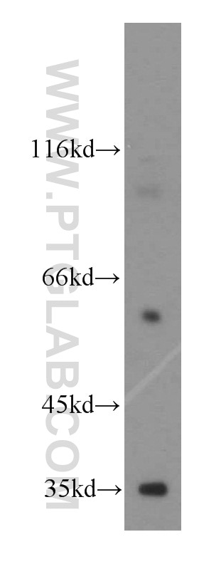 Western Blot (WB) analysis of human testis tissue using FAM49B Polyclonal antibody (20127-1-AP)