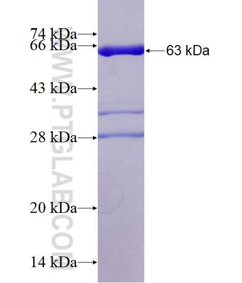 FAM49B fusion protein Ag13939 SDS-PAGE