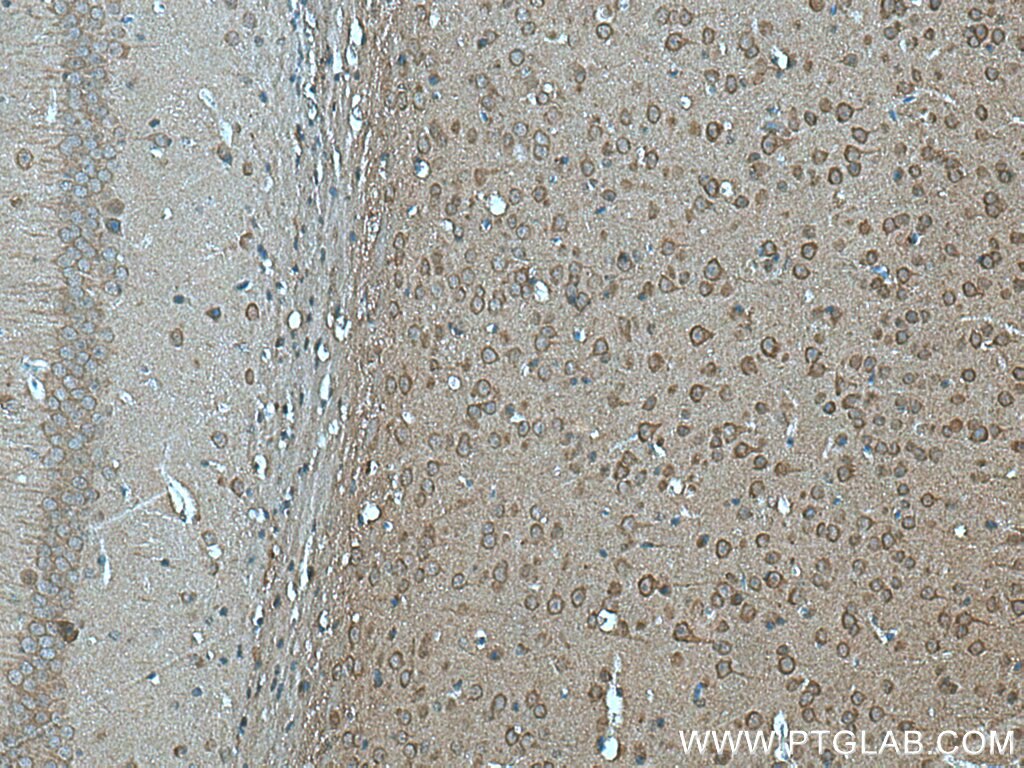 Immunohistochemistry (IHC) staining of mouse brain tissue using FAM57B Polyclonal antibody (20760-1-AP)