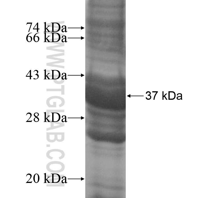 FAM57B fusion protein Ag14707 SDS-PAGE