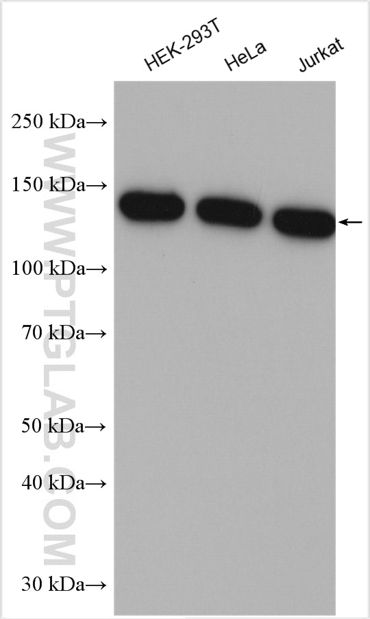 Western Blot (WB) analysis of various lysates using ESYT1 Polyclonal antibody (21450-1-AP)