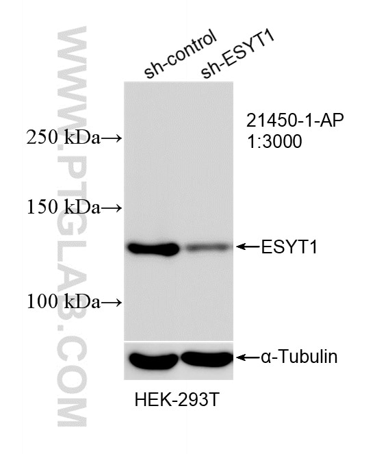 Western Blot (WB) analysis of HEK-293T cells using ESYT1 Polyclonal antibody (21450-1-AP)