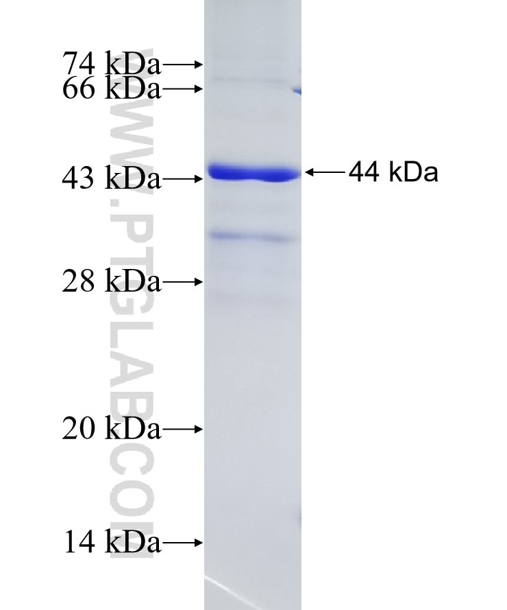 FAM62A fusion protein Ag16840 SDS-PAGE