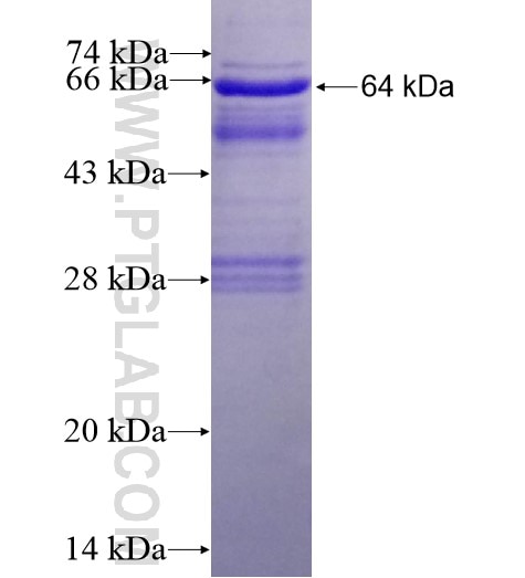 FAM62A fusion protein Ag13895 SDS-PAGE