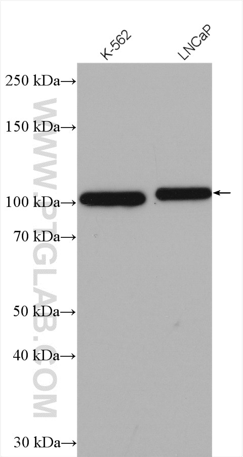 Western Blot (WB) analysis of various lysates using FAM62B Polyclonal antibody (24385-1-AP)