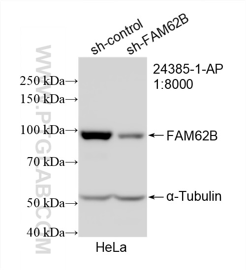 Western Blot (WB) analysis of HeLa cells using FAM62B Polyclonal antibody (24385-1-AP)
