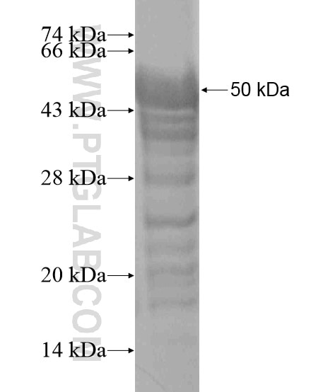 FAM62B fusion protein Ag20420 SDS-PAGE