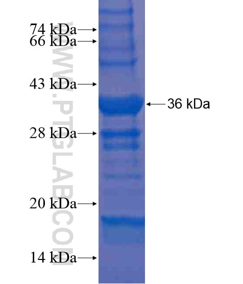 FAM62B fusion protein Ag20440 SDS-PAGE