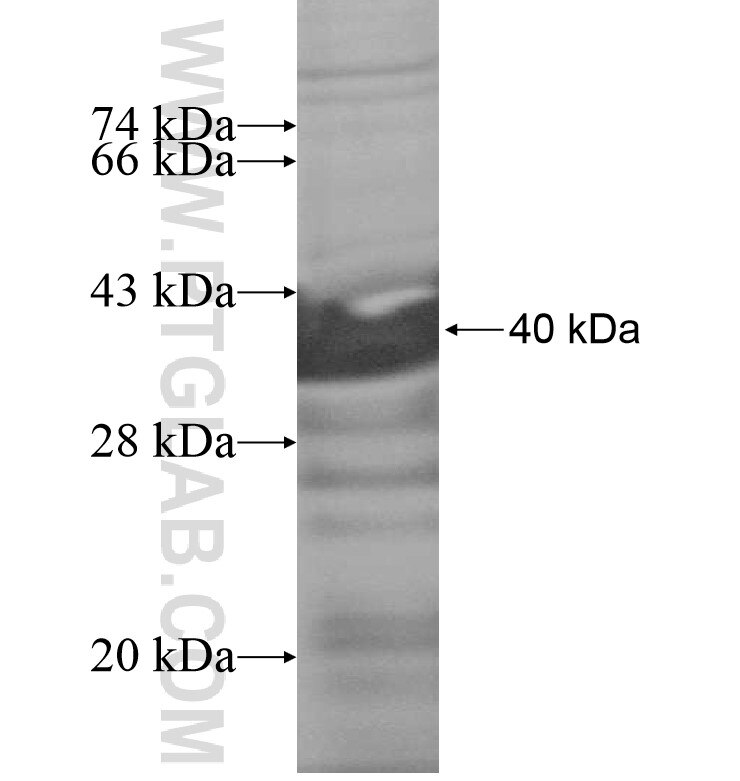 FAM63A fusion protein Ag16179 SDS-PAGE
