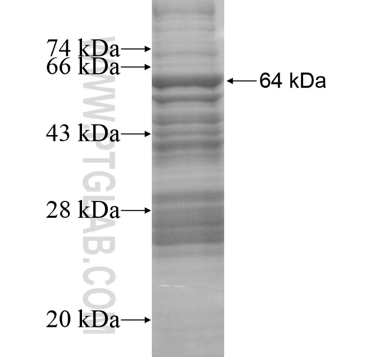 FAM65A fusion protein Ag13878 SDS-PAGE