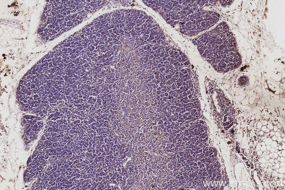 Immunohistochemistry (IHC) staining of mouse thymus tissue using FAM65B Polyclonal antibody (17015-1-AP)