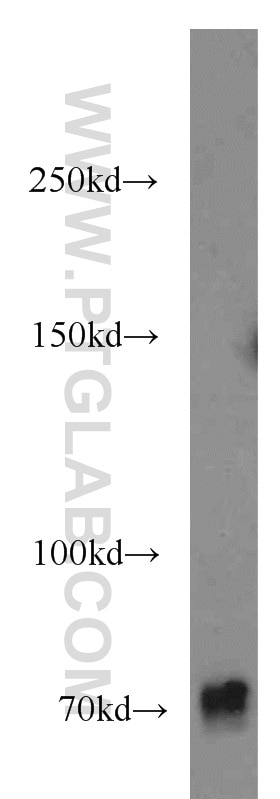 Western Blot (WB) analysis of human skeletal muscle tissue using FAM65B Polyclonal antibody (17015-1-AP)