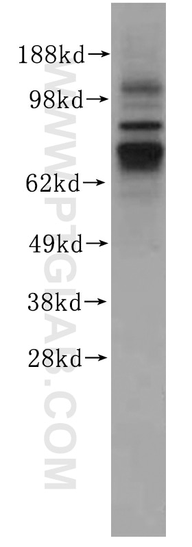 Western Blot (WB) analysis of human skeletal muscle tissue using FAM65B Polyclonal antibody (17015-1-AP)