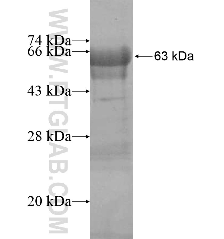 FAM65B fusion protein Ag16889 SDS-PAGE