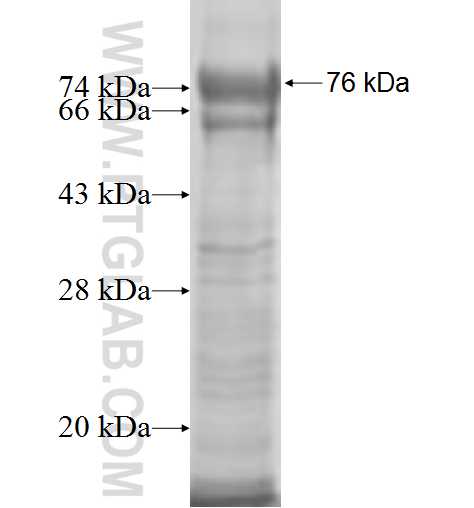 FAM65B fusion protein Ag9991 SDS-PAGE
