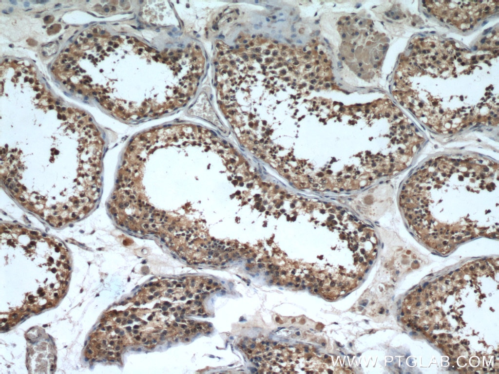 Immunohistochemistry (IHC) staining of human testis tissue using FAM71E2 Polyclonal antibody (20904-1-AP)