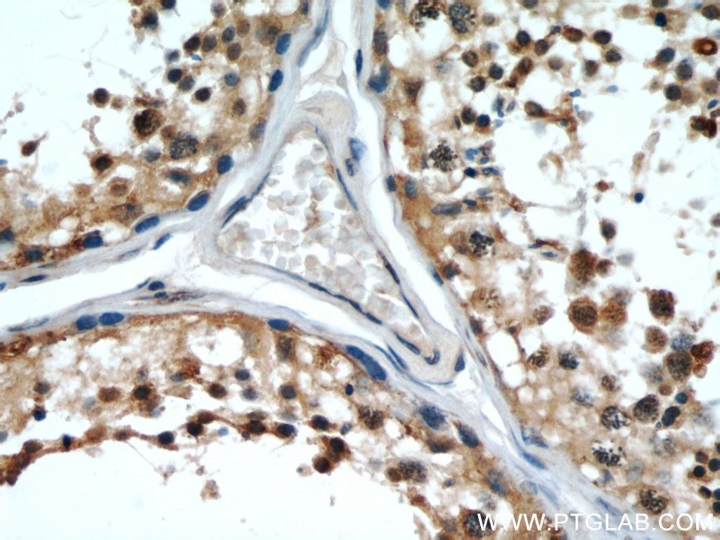 Immunohistochemistry (IHC) staining of human testis tissue using FAM71E2 Polyclonal antibody (20904-1-AP)