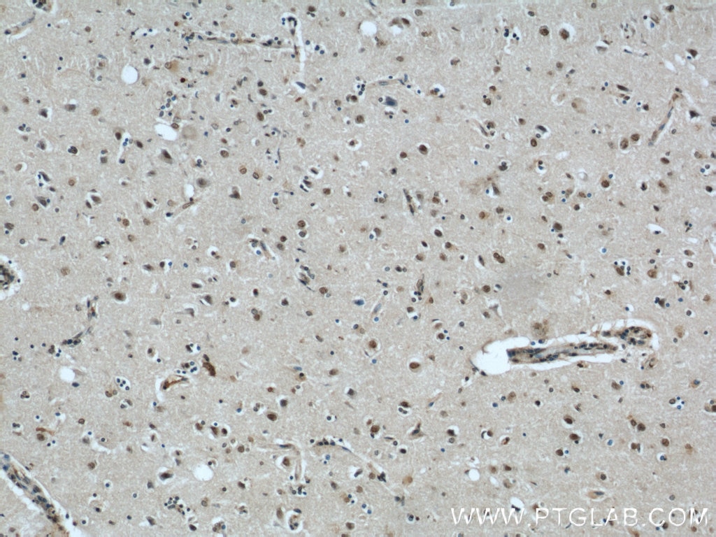 Immunohistochemistry (IHC) staining of human brain tissue using FAM71E2 Polyclonal antibody (20904-1-AP)