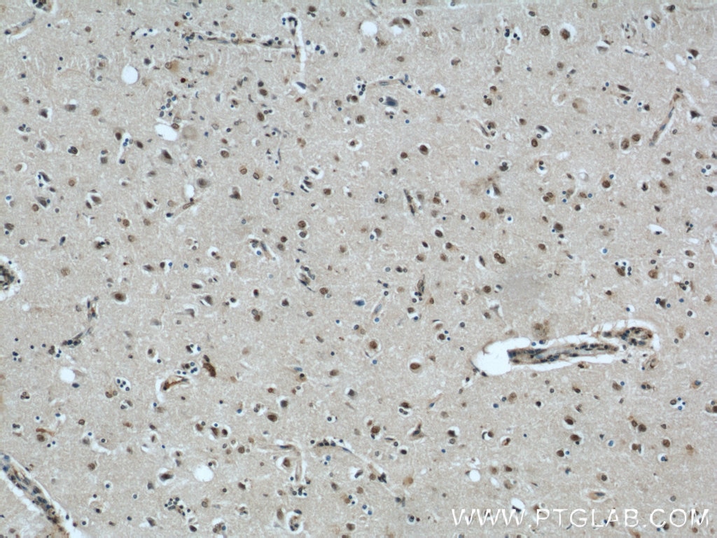 IHC staining of human brain using 20904-1-AP