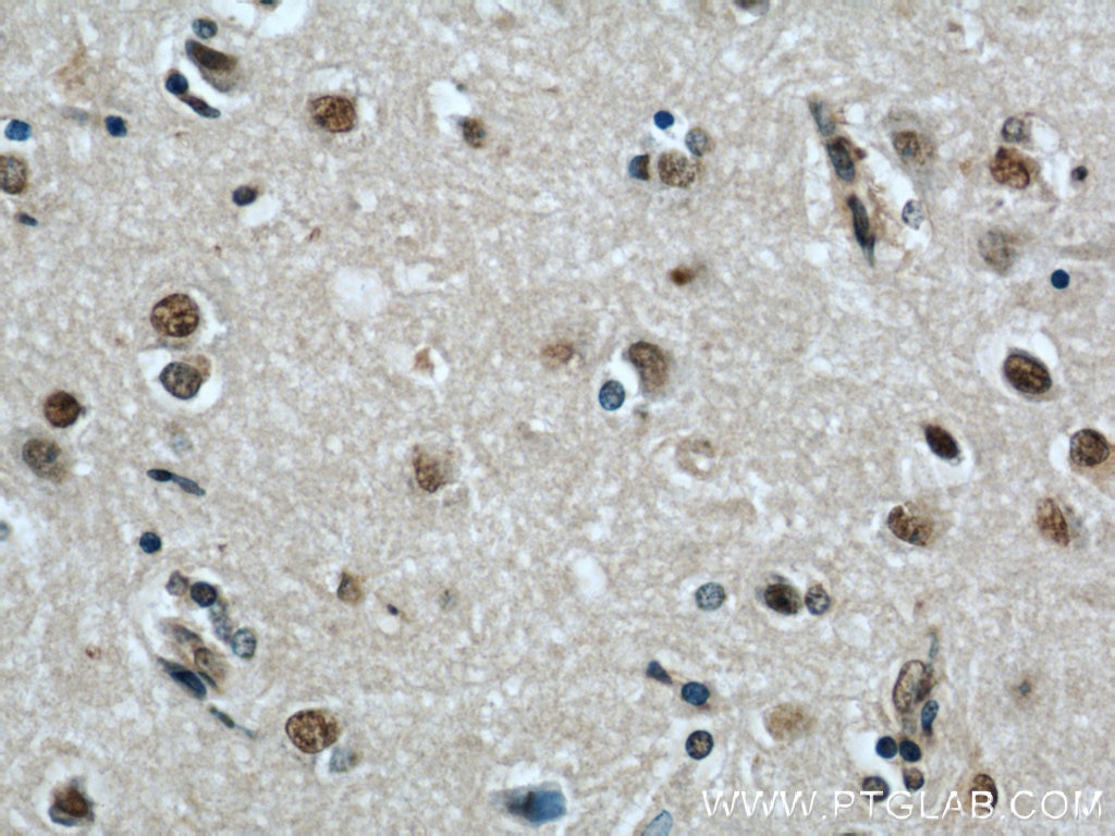 Immunohistochemistry (IHC) staining of human brain tissue using FAM71E2 Polyclonal antibody (20904-1-AP)