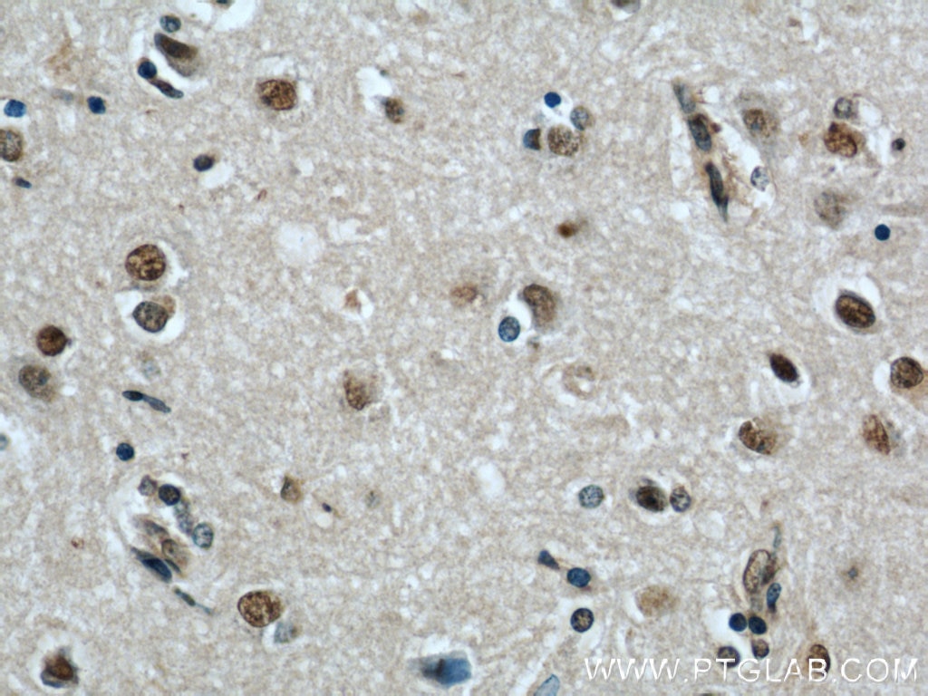 IHC staining of human brain using 20904-1-AP