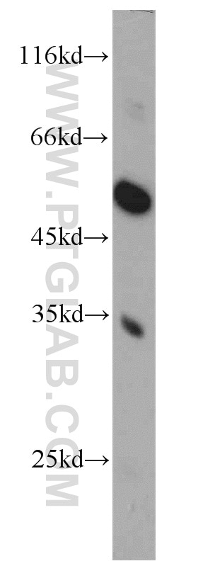 Western Blot (WB) analysis of HepG2 cells using FAM71E2 Polyclonal antibody (20904-1-AP)