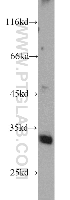 Western Blot (WB) analysis of human brain tissue using FAM71E2 Polyclonal antibody (20904-1-AP)