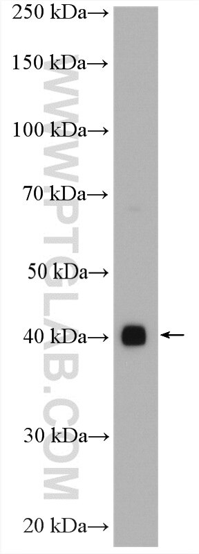 Western Blot (WB) analysis of A549 cells using FAM71F1 Polyclonal antibody (27984-1-AP)