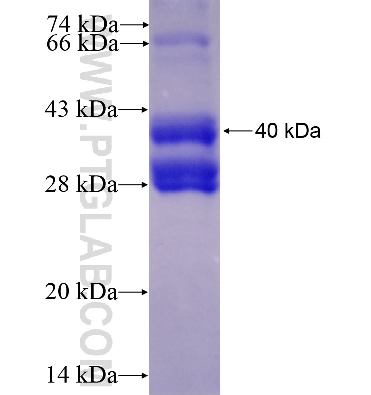 FAM71F1 fusion protein Ag16525 SDS-PAGE