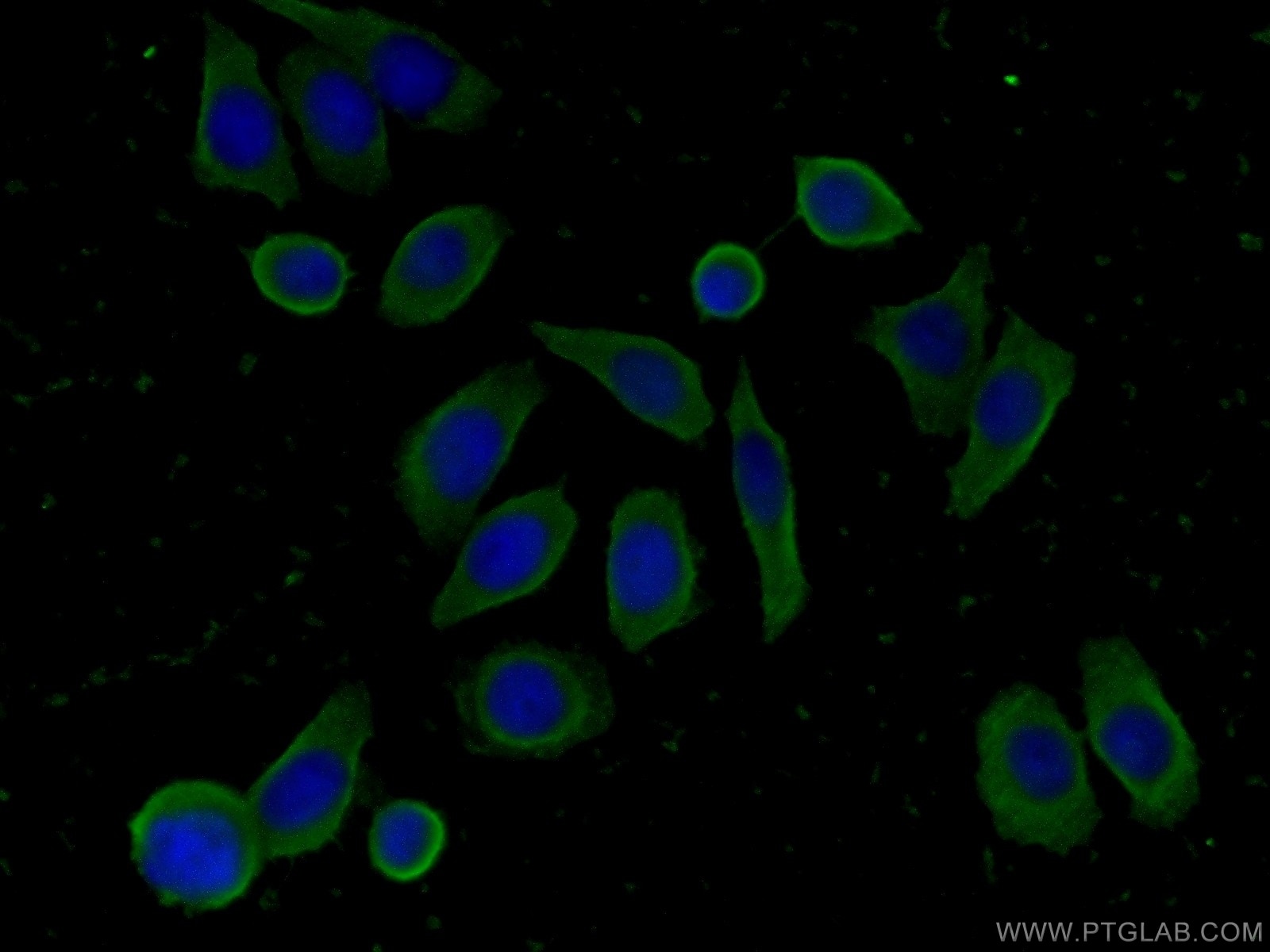 Immunofluorescence (IF) / fluorescent staining of PC-3 cells using FAM71F2 Polyclonal antibody (24286-1-AP)