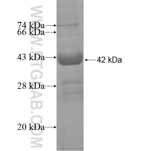 FAM72A fusion protein Ag15566 SDS-PAGE