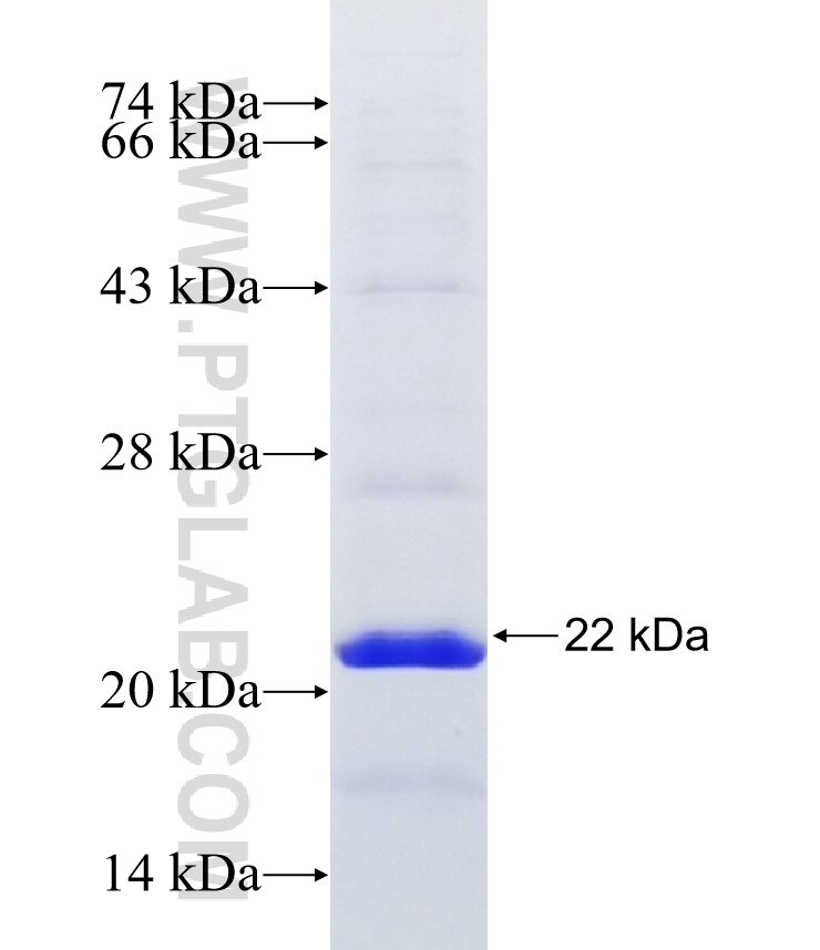 FAM72A fusion protein Ag16627 SDS-PAGE