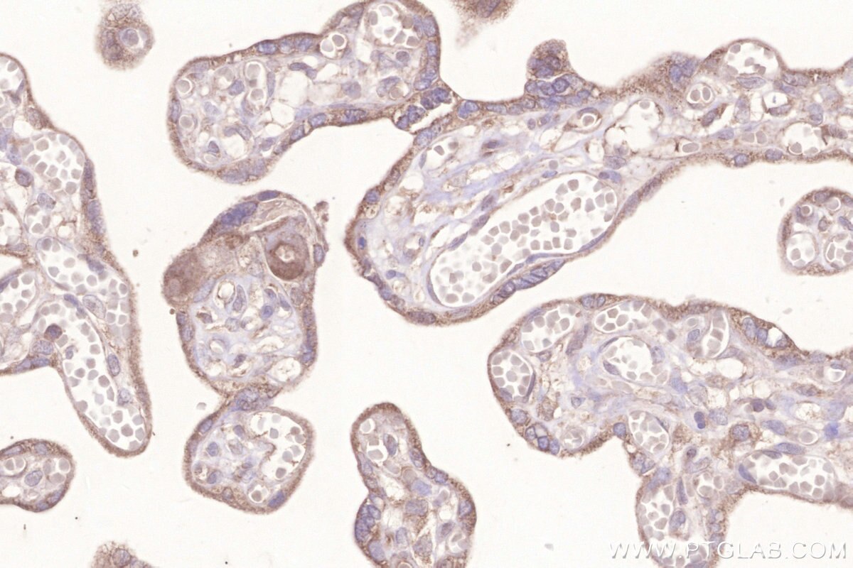 IHC staining of human placenta using 29811-1-AP (same clone as 29811-1-PBS) Immunohistochemistry (IHC) staining of human placenta tissue using MIGA2/FAM73B Polyclonal antibody (29811-1-AP)