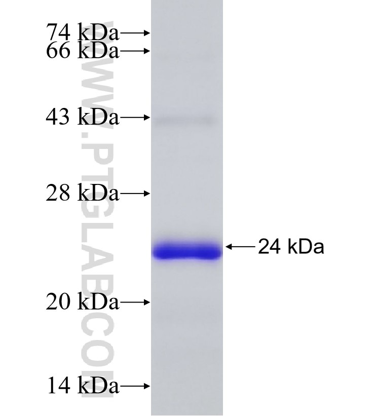 FAM73B fusion protein Ag30577 SDS-PAGE