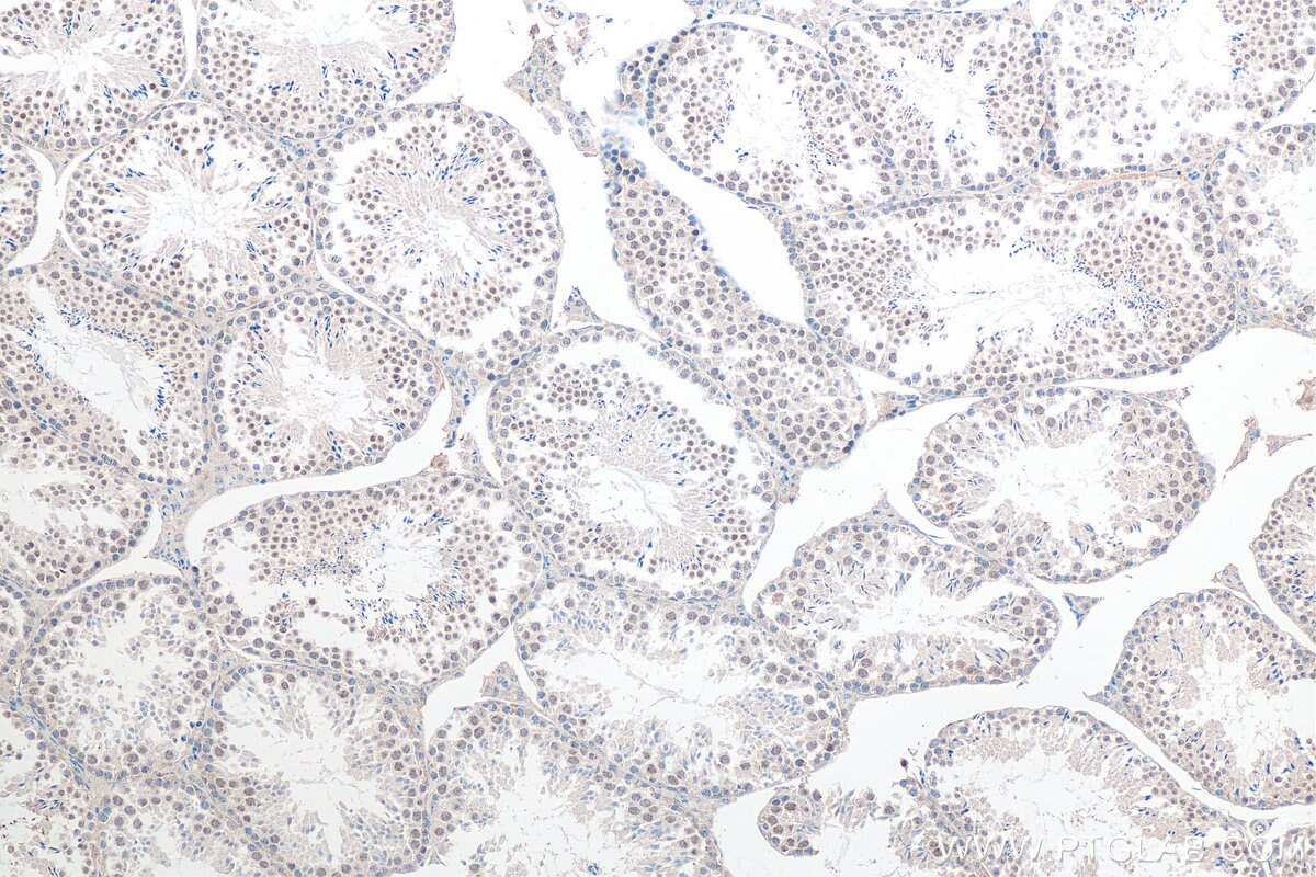 Immunohistochemistry (IHC) staining of mouse testis tissue using FAM76A Polyclonal antibody (20863-1-AP)