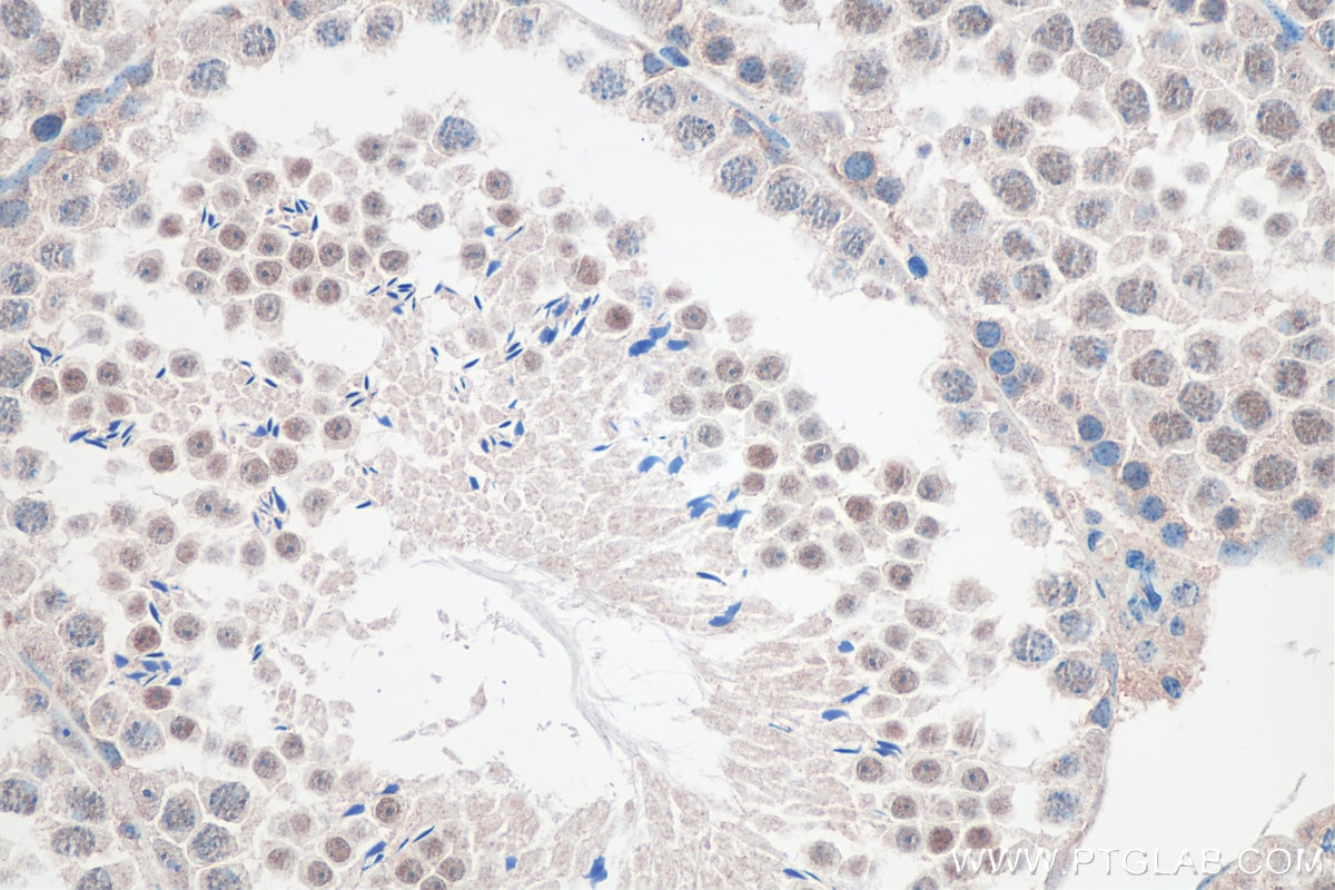 Immunohistochemistry (IHC) staining of mouse testis tissue using FAM76A Polyclonal antibody (20863-1-AP)