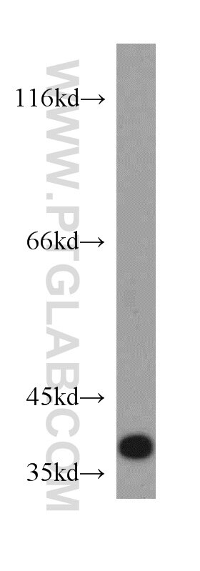 Western Blot (WB) analysis of HeLa cells using FAM76A Polyclonal antibody (20863-1-AP)