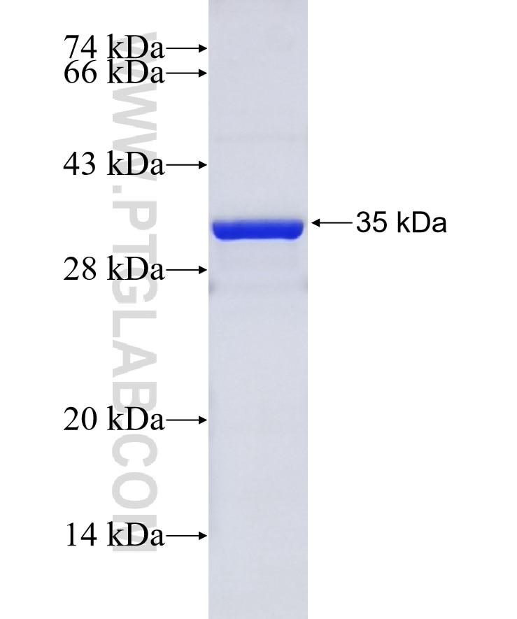 FAM76A fusion protein Ag14904 SDS-PAGE
