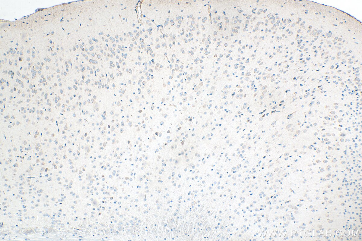 IHC staining of mouse brain using 32882-1-AP Immunohistochemistry (IHC) staining of mouse brain tissue using FAM76B Polyclonal antibody (32882-1-AP)