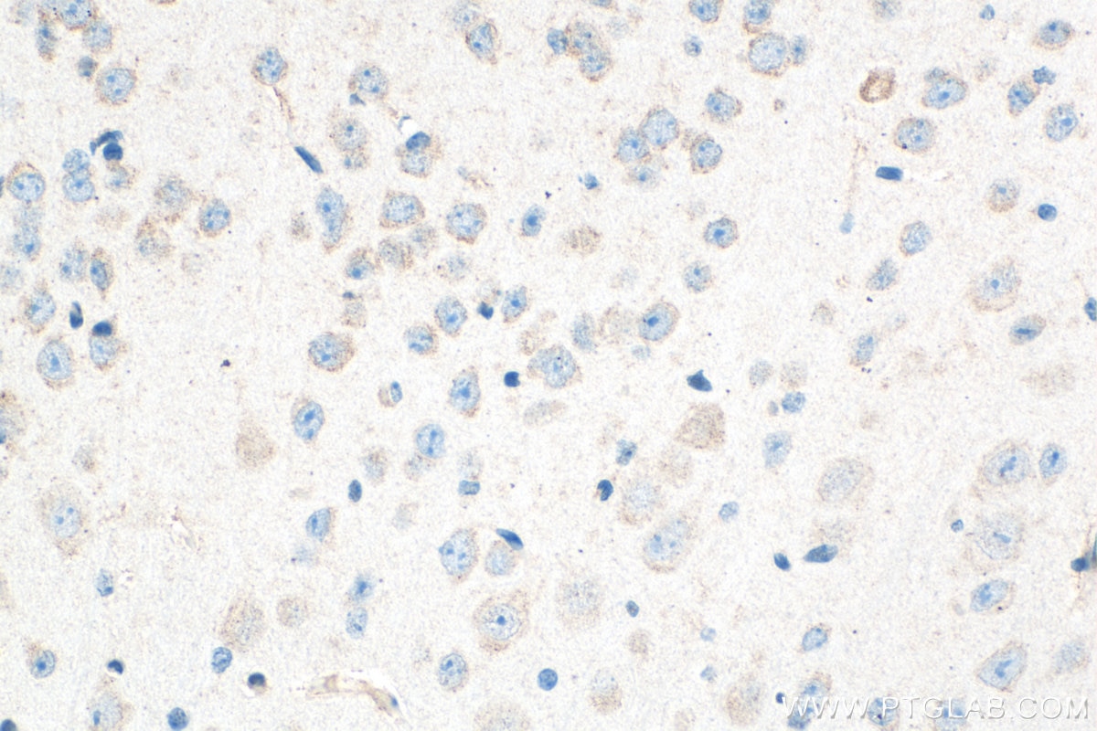 IHC staining of mouse brain using 32882-1-AP Immunohistochemistry (IHC) staining of mouse brain tissue using FAM76B Polyclonal antibody (32882-1-AP)