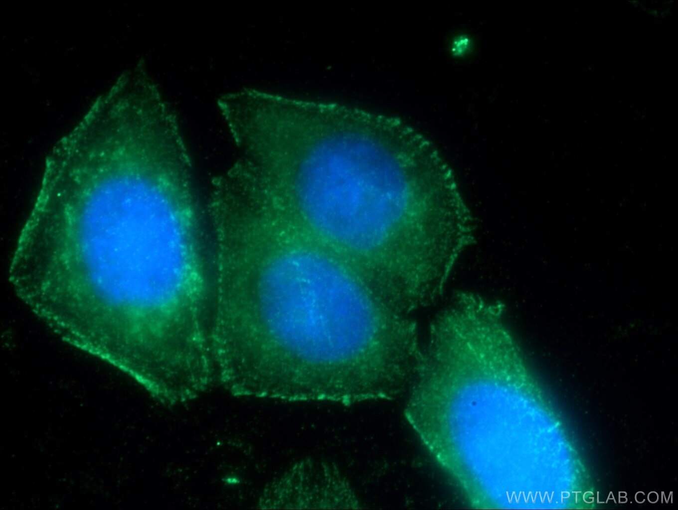 Immunofluorescence (IF) / fluorescent staining of HepG2 cells using FAM78A Polyclonal antibody (21038-1-AP)