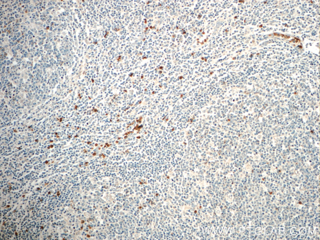 Immunohistochemistry (IHC) staining of human tonsillitis tissue using FAM78A Polyclonal antibody (21038-1-AP)