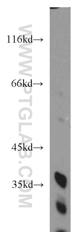 Western Blot (WB) analysis of mouse spleen tissue using FAM78A Polyclonal antibody (21038-1-AP)