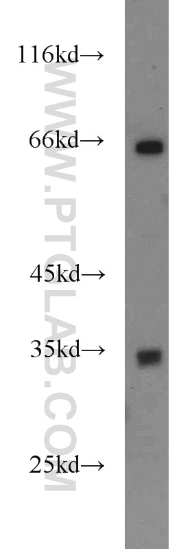 Western Blot (WB) analysis of mouse liver tissue using FAM78A Polyclonal antibody (21038-1-AP)