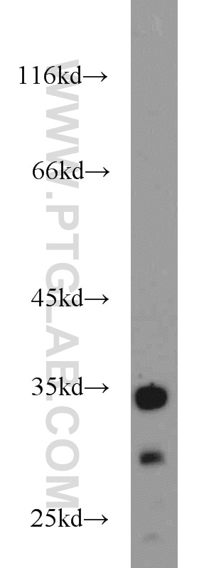 Western Blot (WB) analysis of mouse spleen tissue using FAM78A Polyclonal antibody (21038-1-AP)