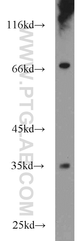 Western Blot (WB) analysis of human liver tissue using FAM78A Polyclonal antibody (21038-1-AP)