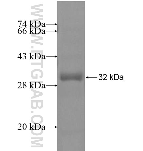 FAM78A fusion protein Ag15366 SDS-PAGE