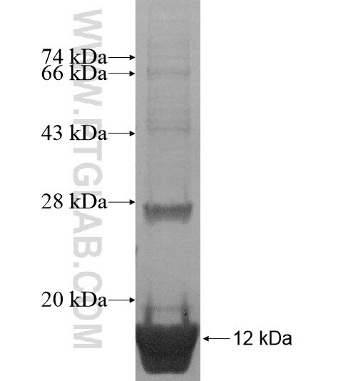 FAM78A fusion protein Ag15643 SDS-PAGE