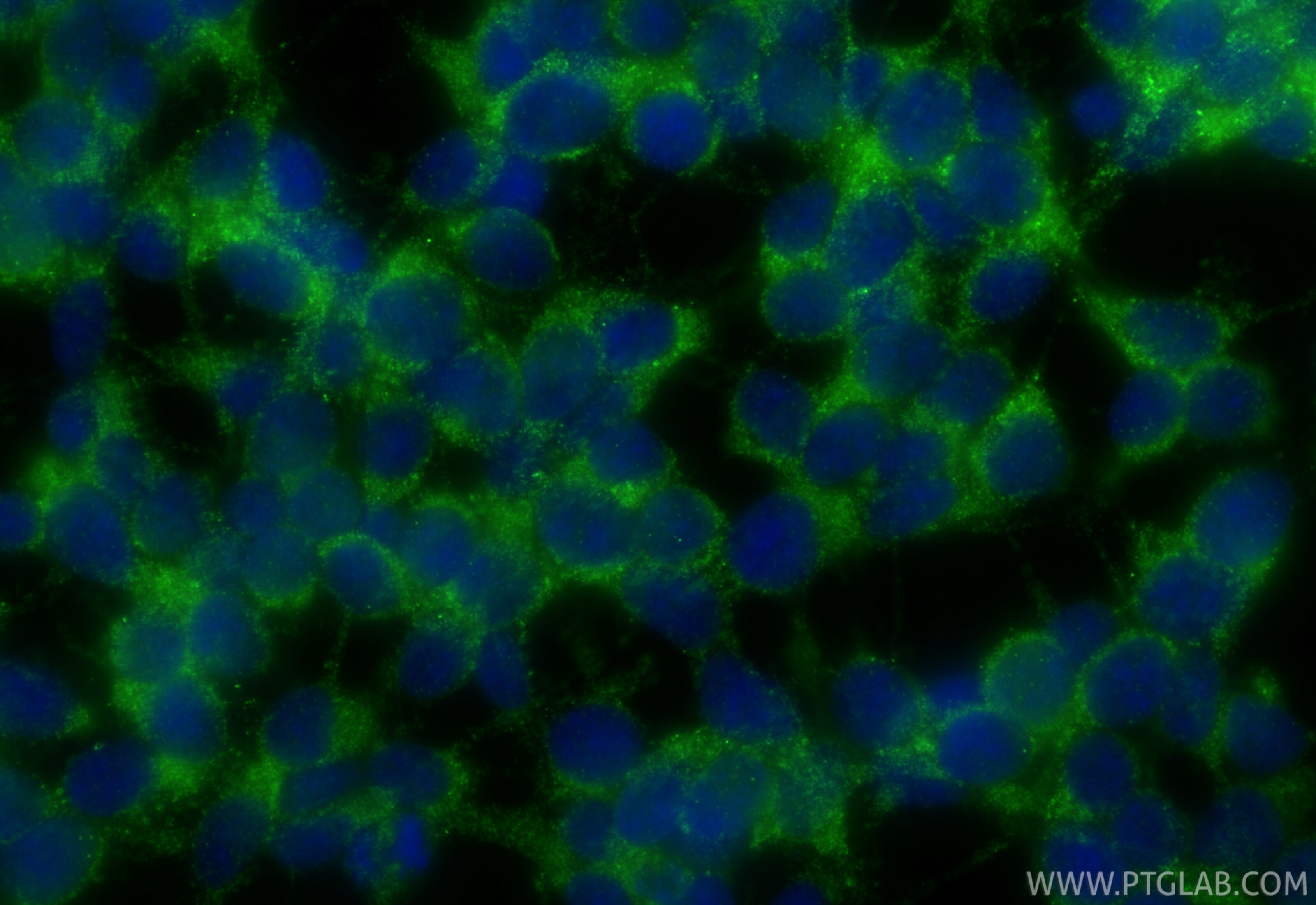 Immunofluorescent analysis of (-20°C Ethanol) fixed SH-SY5Y cells using FAM82A1 antibody (33752-1-AP) at dilution of 1:400 and CoraLite®488-Conjugated Goat Anti-Rabbit IgG(H+L) (SA00013-2). Immunofluorescence (IF) / fluorescent staining of SH-SY5Y cells using FAM82A1 Polyclonal antibody (33752-1-AP)