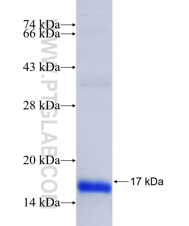 FAM82A1 fusion protein Ag40549 SDS-PAGE FAM82A1 fusion protein Ag40549 SDS-PAGE